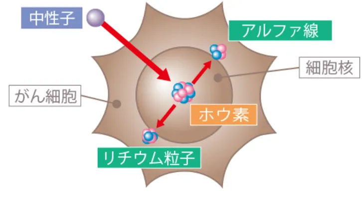 BNCTは放射線がん治療法